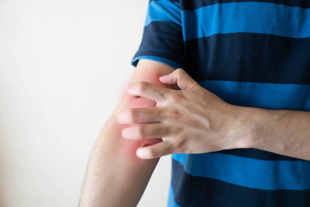 इंसेक्ट्स से होने वाले इन्फेक्शन से इस तरह से आप कर सकते हैं बचाव