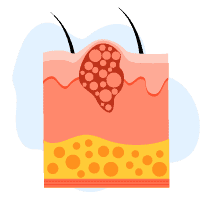 स्क्रब के कारण स्किन कैंसर का खतरा बढ़ सकता है, इस्तेमाल से पहले फॉलो करें एक्सपर्ट के टिप्स