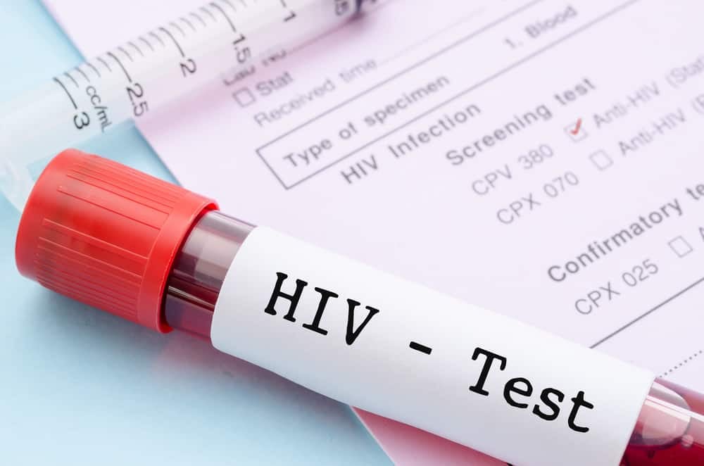 एचआईवी (HIV) के लिए एलिसा टेस्ट कैसे किया जाता है?