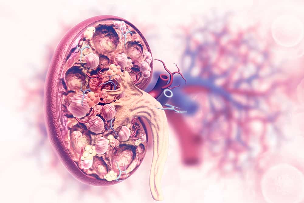 Kidney Disease: अगर हो रही हैं ये बीमारियां, तो टॉक्सिंस को शरीर से बाहर निकलना बन जाएगा मुश्किल!
