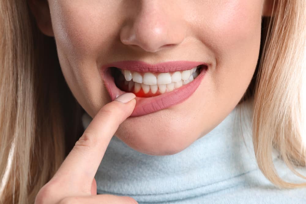 Gum diseases: मसूड़ों की बीमारी को कहीं आप इग्नोर तो नहीं कर रहे हैं?