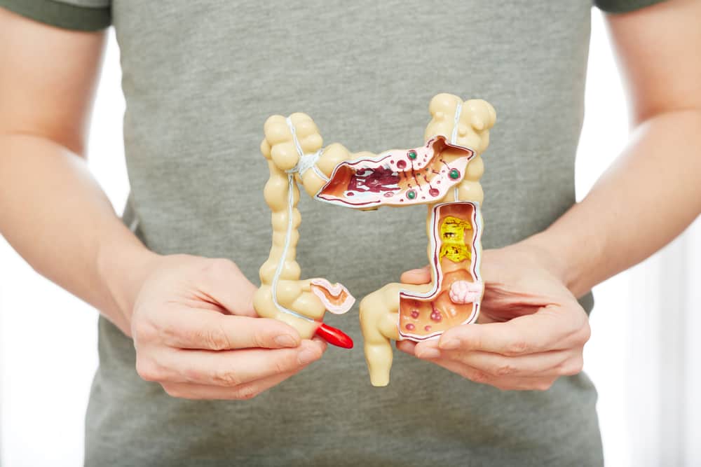 Natural Laxatives : ये प्राकृतिक लैक्सेटिवस कब्ज से दिला सकती है छुटकारा!