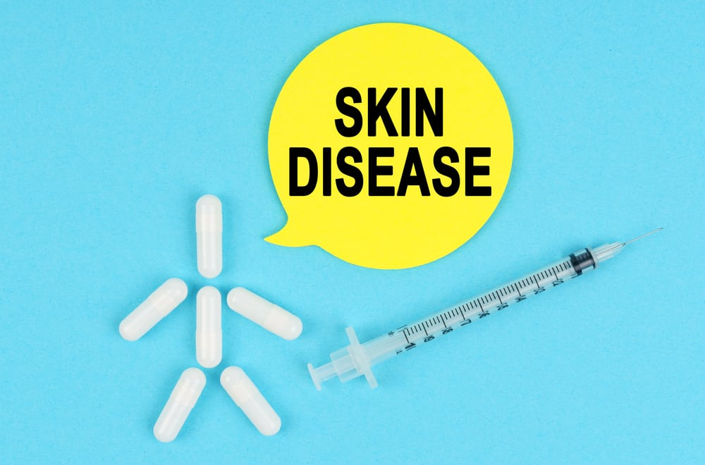 टाइप 2 डायबिटीज के मरीज कभी इग्नोर न करें इन स्किन कंडिशंस को