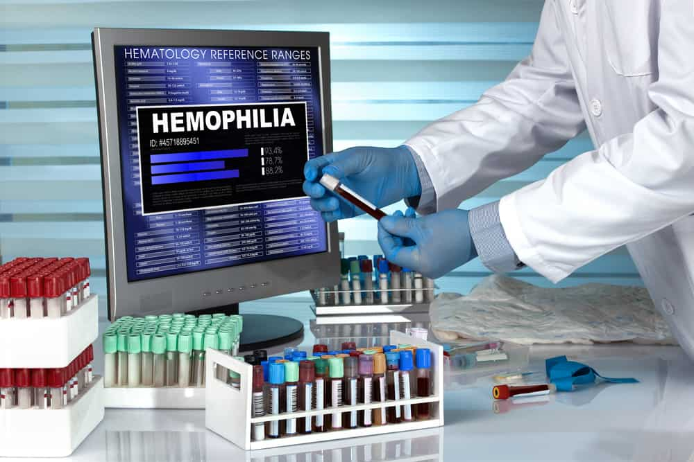 Hemophilia: कुछ ऐसे किया जाता है हीमोफीलिया का ट्रीटमेंट!