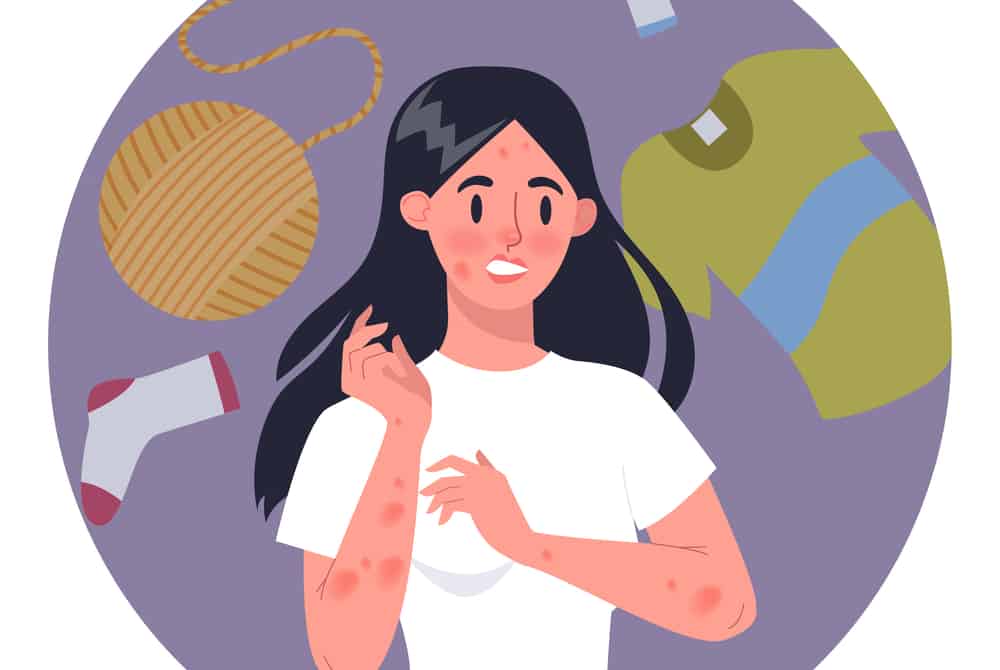 पॉलिएस्टर एलर्जी : कपड़े भी बन सकते हैं एलर्जी की वजह