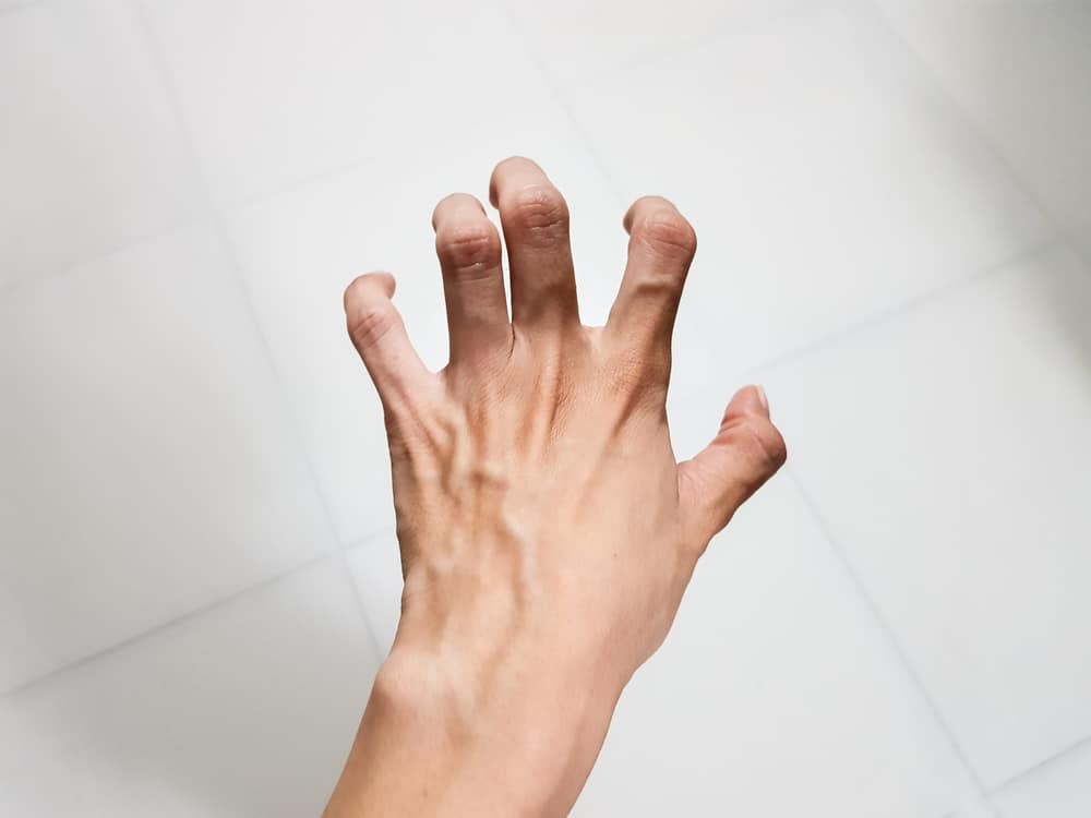 मसल स्पास्टिसिटी:  मांसपेशियों की इस तकलीफ के बारे में जानते हैं आप?