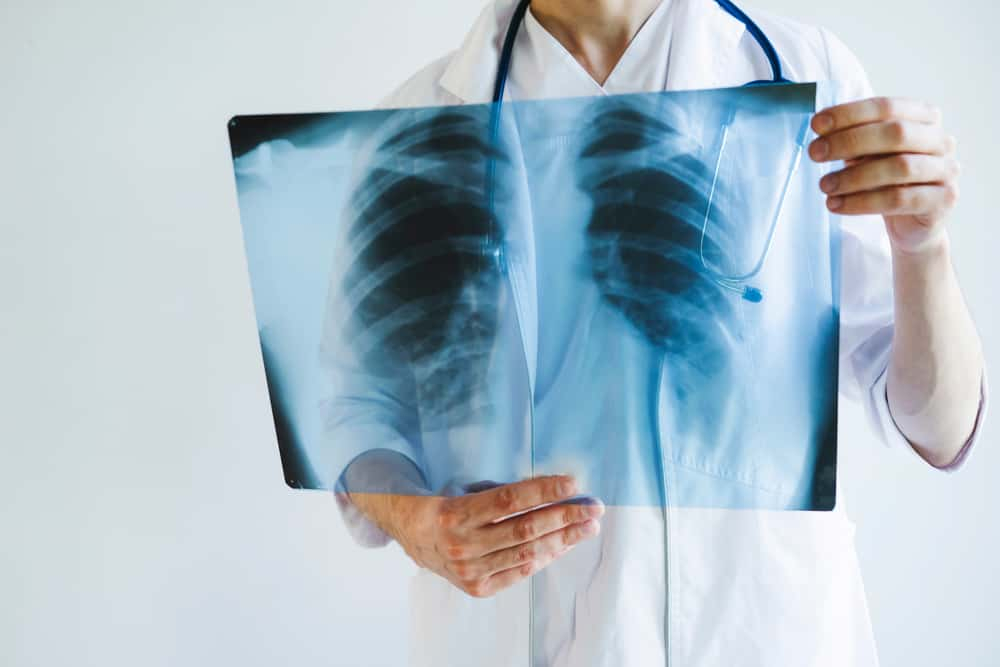 लंग नीडल बायोप्सी : क्यों और कब किया जाता है यह टेस्ट?