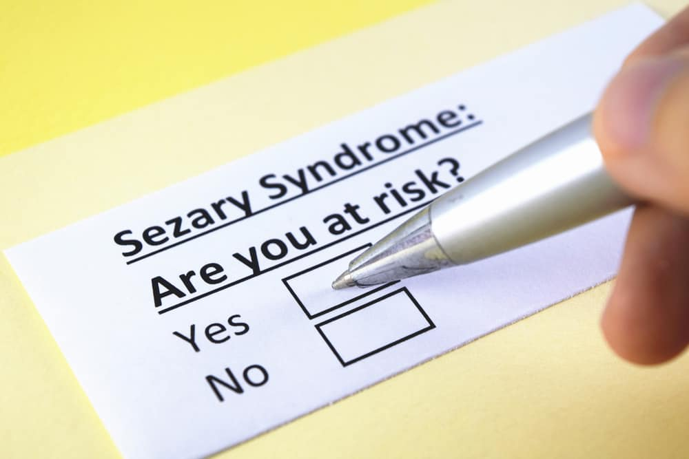 सेजरी सिंड्रोम: यह कोई मानसिक बीमारी नहीं, है ब्लड कैंसर का दुर्लभ प्रकार