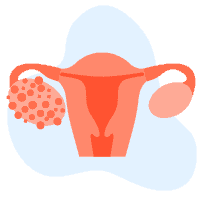 ओवेरियन कैंसर भारत का तीसरा अधिक जानलेवा कैंसर है, बचाव के लिए जानें एक्सपर्ट की राय