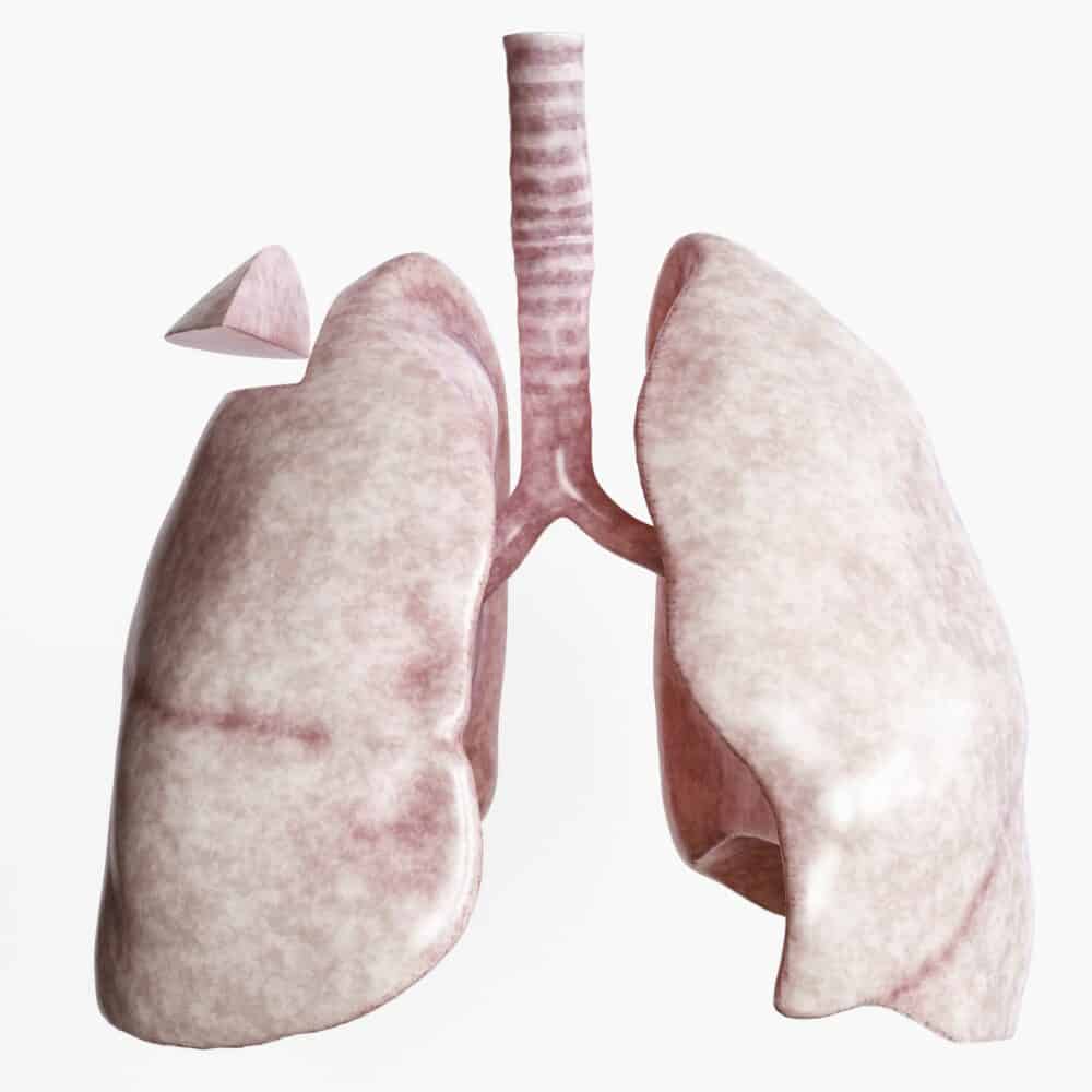 Wedge Resection: वेज रिसेक्शन कैसे कम करता है फेफड़ों की समस्या को, जानिए यहां