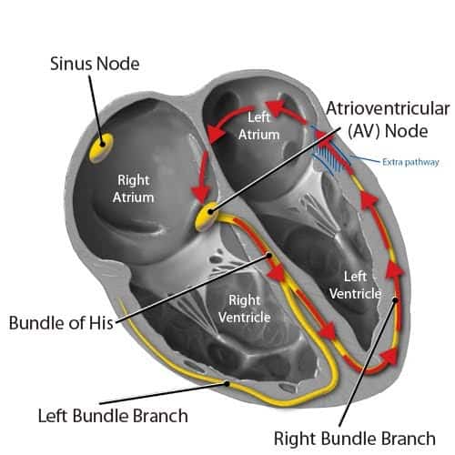 Supraventricular tachycardia: सुप्रावेंट्रिक्यूलर टैचीकार्डिया क्या है, जानें इसका इलाज, कारण और लक्षण!