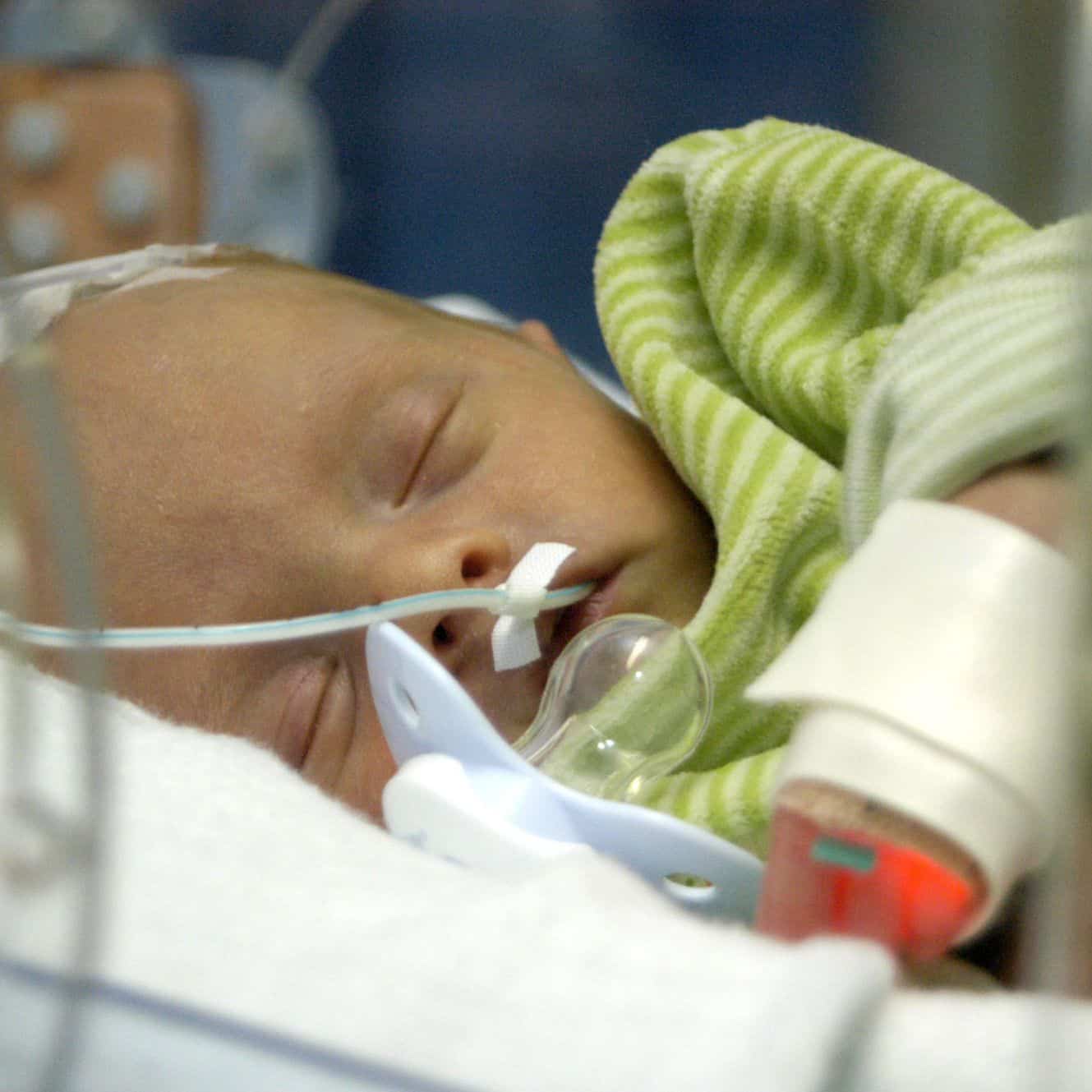 शिशु के लिए फीडिंग ट्यूब क्यों होती है जरूरी और किन बातों का रखा जाता है ध्यान?