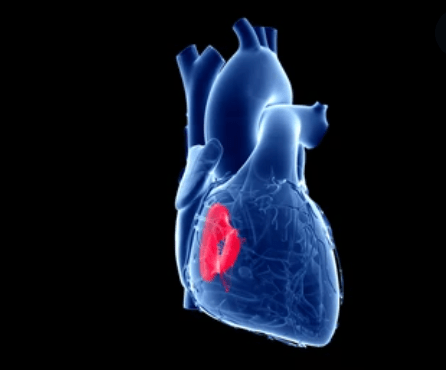 हाय ब्लड प्रेशर लो पल्स क्या है, इन बातों का रखें ध्यान