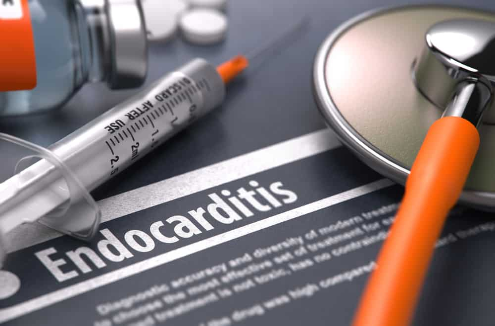 Infective endocarditis Causes: दिल के चैम्बर्स में सूजन के हो सकते हैं ये कारण!