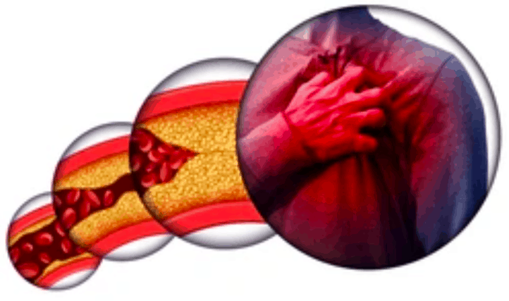 मक्खन और कोलेस्ट्रॉल के बीच तालमेल बिठाना हैं, तो पढ़ें ये लेख!