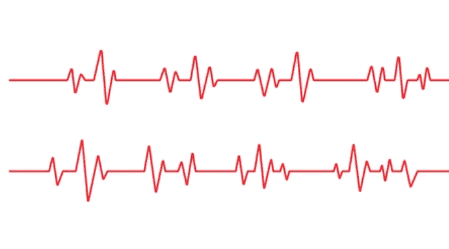 हार्ट पेशेंट : समय न होने पर खुद को कैसे एक्टिव रखा जाए?