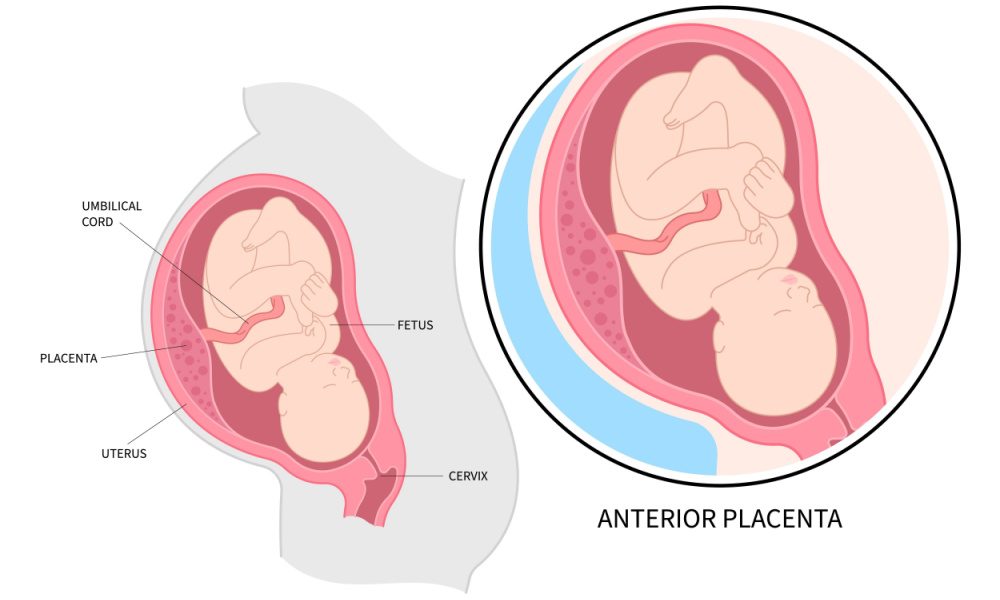 एंटीरियर प्‍लेसेंटा (Anterior Placenta) क्या है? क्या प्रेग्नेंसी में इससे बच्चे को नुकसान पहुंच सकता है?