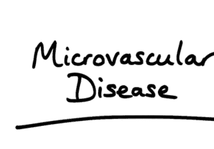 Coronary Microvascular Disease: कोरोनरी माइक्रोवास्कुलर डिजीज के बारे में जानिए विस्तार से!