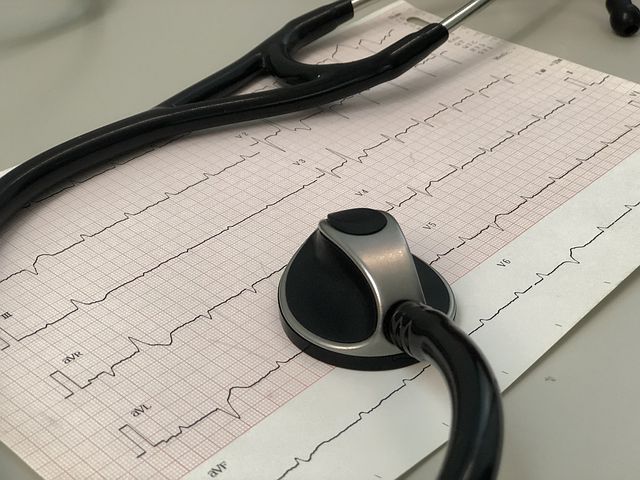 ईसीजी रिपोर्ट कैसे पढ़ें? जानें कैसे ECG से हार्ट अटैक की जानकारी मिल सकती है?