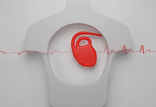 Ventricular Arrhythmia: वेंट्रिकुलर एरिथमिया क्या है? जानिए इसके लक्षण, कारण और इलाज