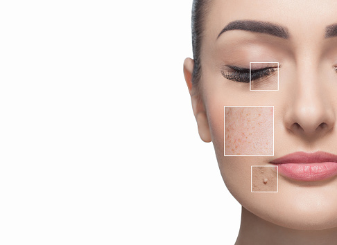 Dark spots: चेहरे पर डार्क स्पॉट्स के कारण क्या हैं? डार्क स्पॉट्स की समस्या है समस्या, तो करें ये उपाय