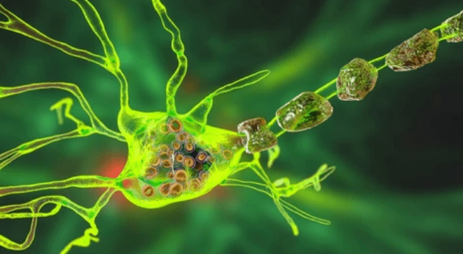 GM2-gangliosidosis: GM2 गैंग्लियोसिडोसिस क्या है, शरीर का कौन सा हिस्सा होता है प्रभावित?