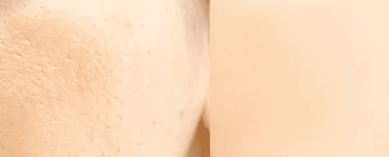 लार्ज पोर्स से छुटकारे के लिए क्या अपनाएं जा सकते हैं उपाय, जानिए यहां!