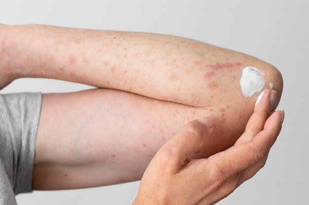 Rare Skin Diseases: कौन सी हैं रेयर स्किन डिजीज, जानें
