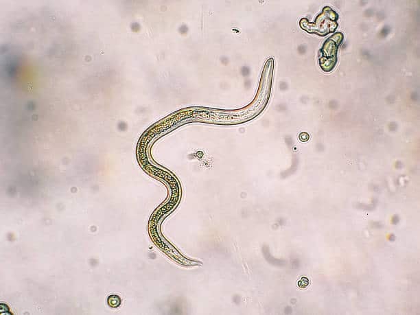 Parasitic Worms: पैरासाइटिक वर्म के लक्षण, कारण और इलाज क्या हैं?