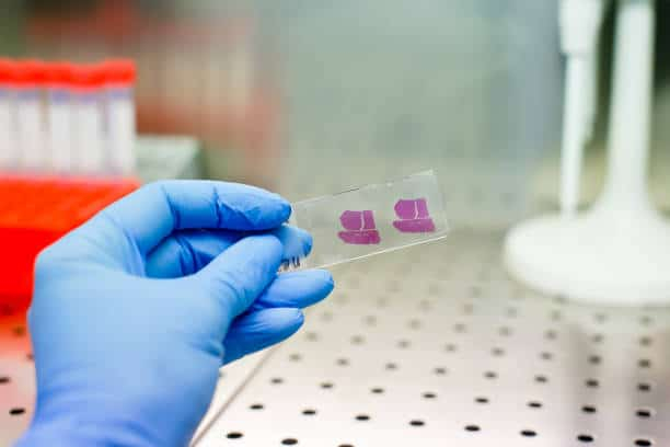 Gastric Tissue Biopsy: क्यों की जाती है गैस्ट्रिक टिश्यू बायोप्सी, जानें