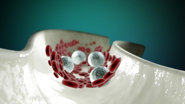 क्या धमनियों को खोलना संभव है?