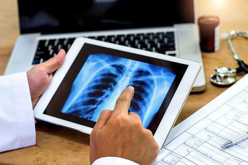 Spinal Cord Tumor: नजरअंदाज न करें इस कैंसर के लक्षणों को !