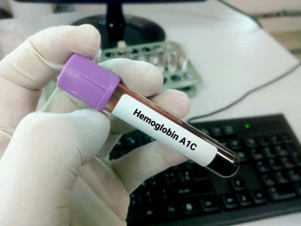 A1C टेस्ट की मदद से डायबिटीज के निदान के क्या हैं फायदे और क्या हो सकते हैं नुकसान, जानिए!