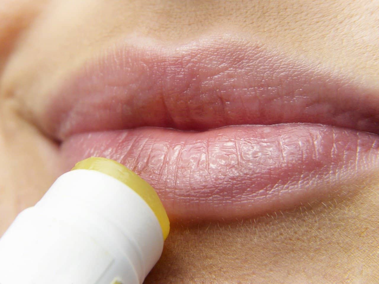 Chapped lips: हो जाए चैप्ड लिप्स की समस्या, तो कौन-से उपाय अपनाएं?