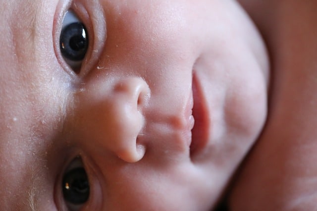 शिशु के चेहरे पर रूखी त्वचा (Dry Skin On A Baby's Face) किन कारणों से होती है?