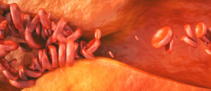 Angioplasty After a Heart Attack: हार्ट अटैक के बाद एंजियोप्लास्टी के दौरान क्या होता है?