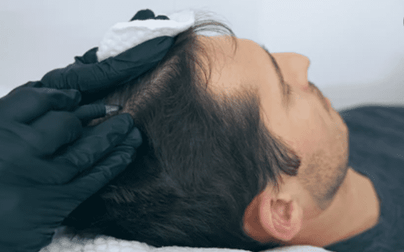 ये कंडीशंस प्रभावित कर सकती हैं स्कैल्प को, जानिए इसके बारे में अधिक जानकारी!