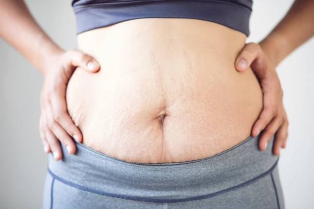 Pregnancy Rash: प्रेग्नेंसी में रैश के कारण क्या हो सकते हैं?