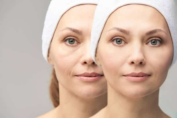 Facial Swelling: फेशियल स्वेलिंग क्या हैं? जानिए फेशियल स्वेलिंग के 15 कारण और बचाव!
