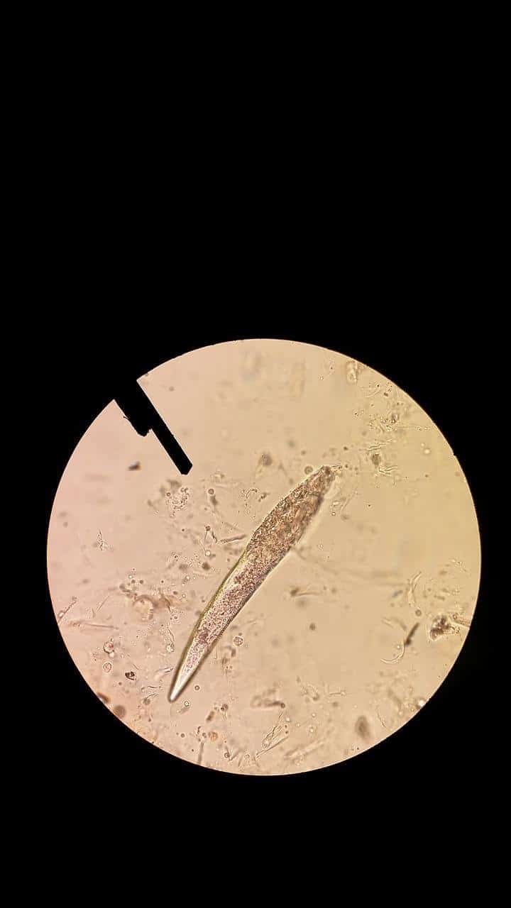 डेमोडेक्स फॉलिकलोरम (Demodex folliculorum) : स्किन में रहने वाले इन पैरासाइट के बारे में जानते हैं आप?