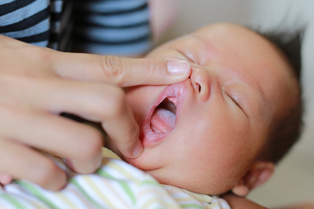 बेबी लिप ब्लिस्टर्स क्यों होते हैं? जानिए कैसे कर सकते हैं इनको अवॉइड