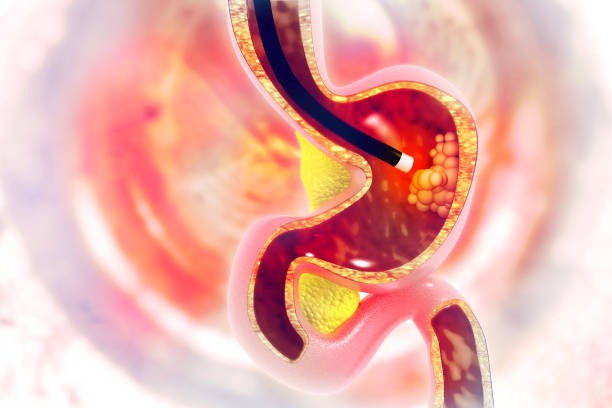 Colonoscopy Test: कोलोनोस्कोपी टेस्ट की जरूरत कब पड़ सकती है?