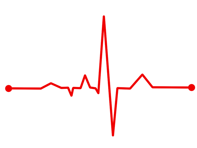 कार्डियोवर्जन (Cardioversion) ट्रीटमेंट प्लान कैसे मदद करता है हार्ट पेशेंट्स की?