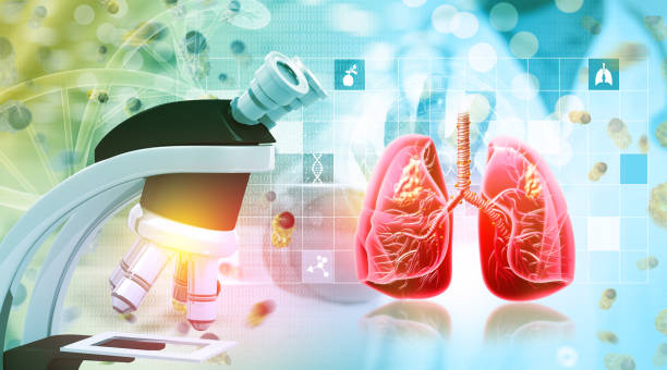 Lung Cancer Stages: लंग कैंसर स्टेज के बारे में पूरी जानकारी!