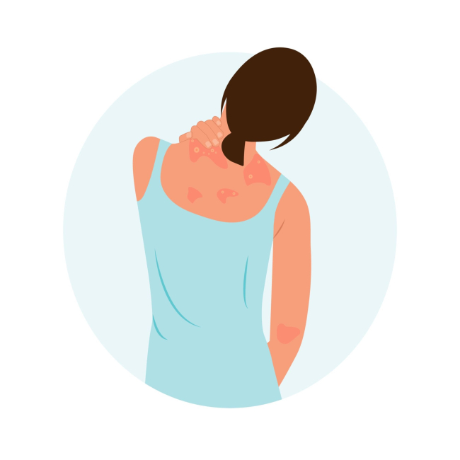 डर्मेटाइटिस नेगलेक्टा (Dermatitis neglecta) : हायजीन न रखने के कारण होती है ये स्किन कंडिशन!