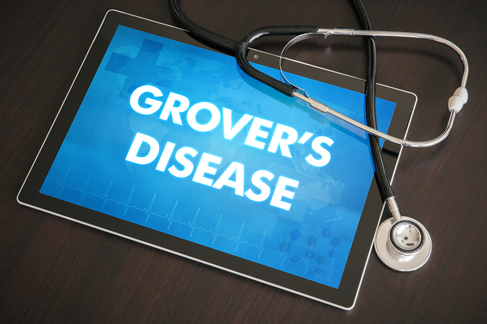 ग्रोवर्स डिजीज (Grover’s disease) क्या है?