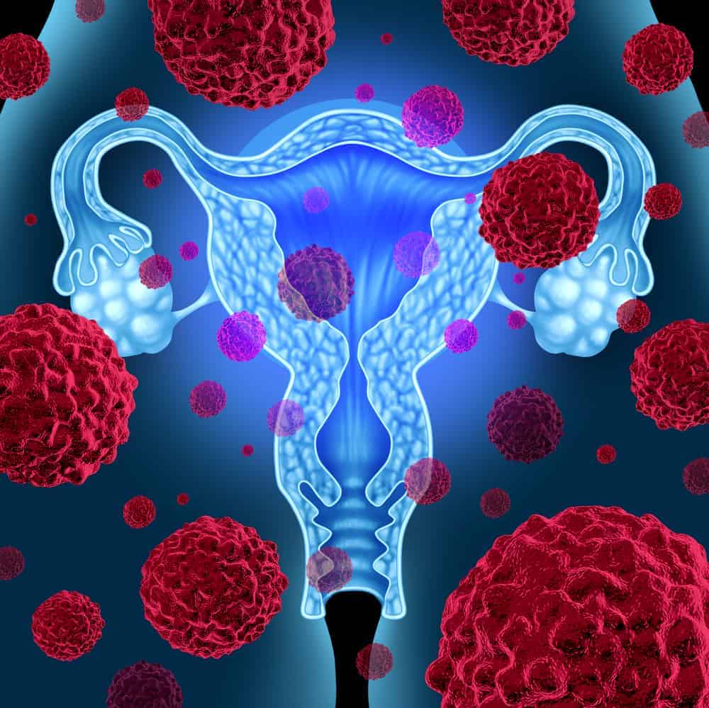 सर्वाइकल कैंसर में इम्यूनोथेरिपी (Immunotherapy in Cervical cancer) के उपयोग के बारे में जानें