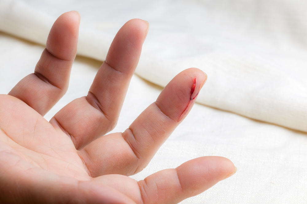 उंगली कट गई हो तो तत्काल करें ये काम, Finger Cut होने पर कब जाएं डॉक्टर के पास?