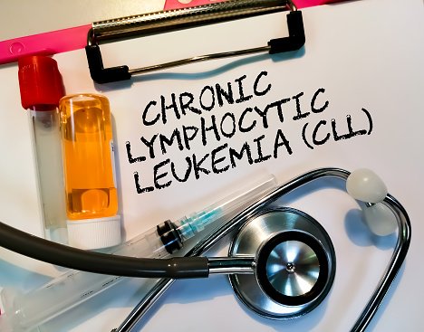Chronic Lymphocytic Leukemia: इन लक्षणों को ना करें इग्नोर, क्योंकि ये इशारा है क्रोनिक लिम्फोसाईटिक ल्यूकेमिया की ओर!